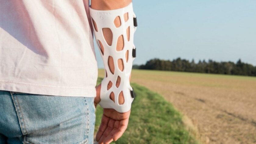 10 Chief Reasons Behind Using 3d Printed Orthotics 